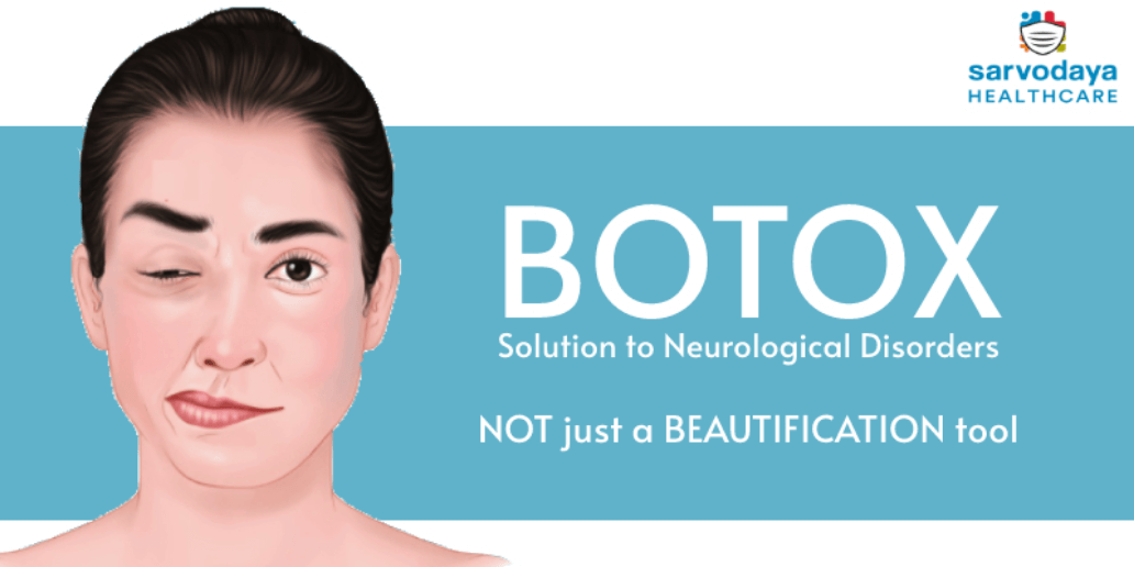 Botox Therapy for Neurology Disorder